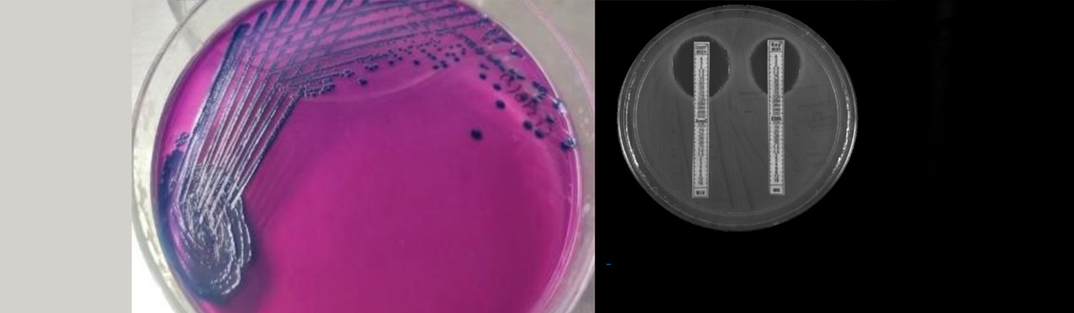 Fisheries Resources, Harvest & Post-Harvest Management Division